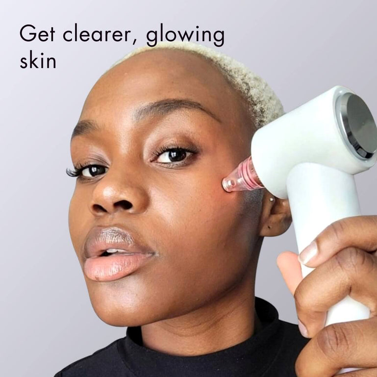 Clara in-home microdermabrasion machine by Fancii and Co All